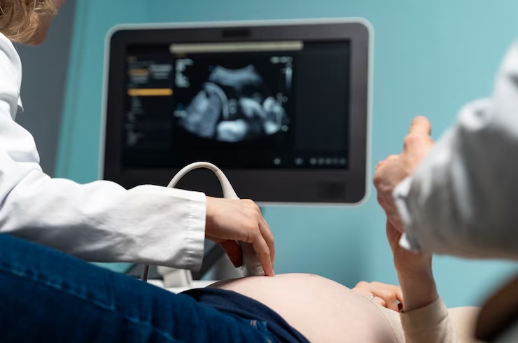3D_4D Ultrasound