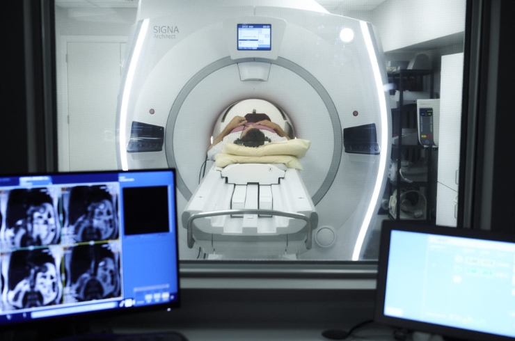 CT Coronary Angiography-----14