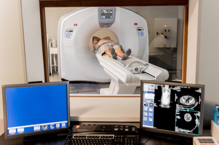 CT Scan